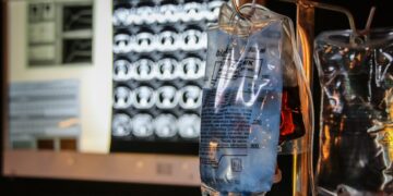 Il caso “Libera” alla Consulta: paralizzata e malata di sclerosi, chiede l’eutanasia con assistenza medica